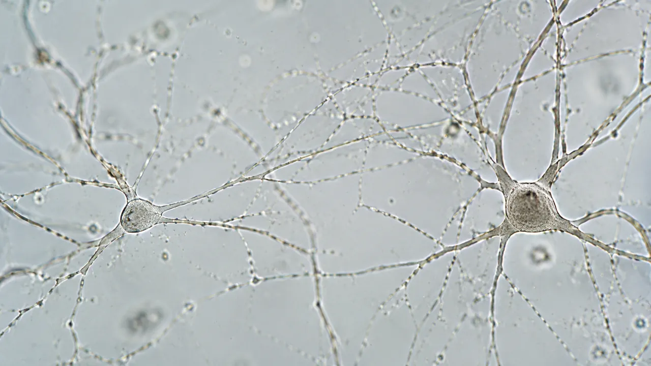 Neuron dendrites under magnification